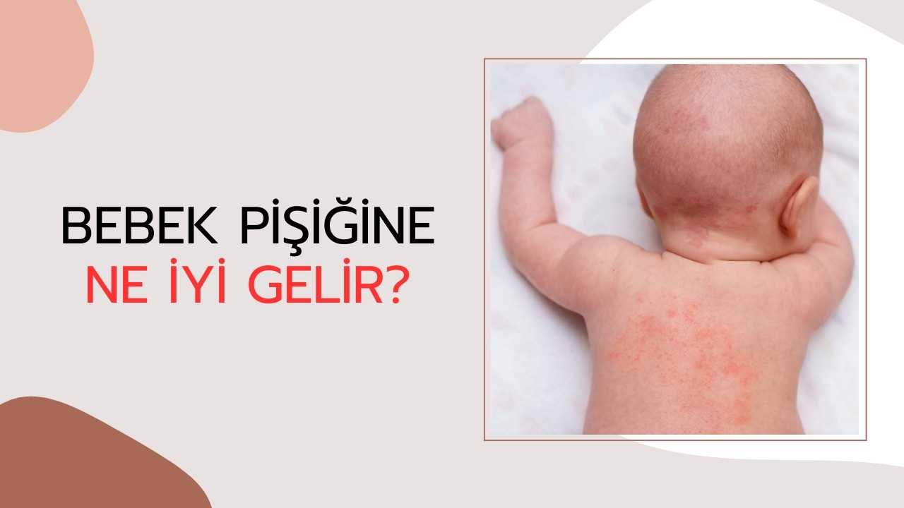 Bebek Pişiğine Ne İyi Gelir?